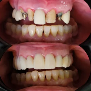 IMG_20221123_135159_214